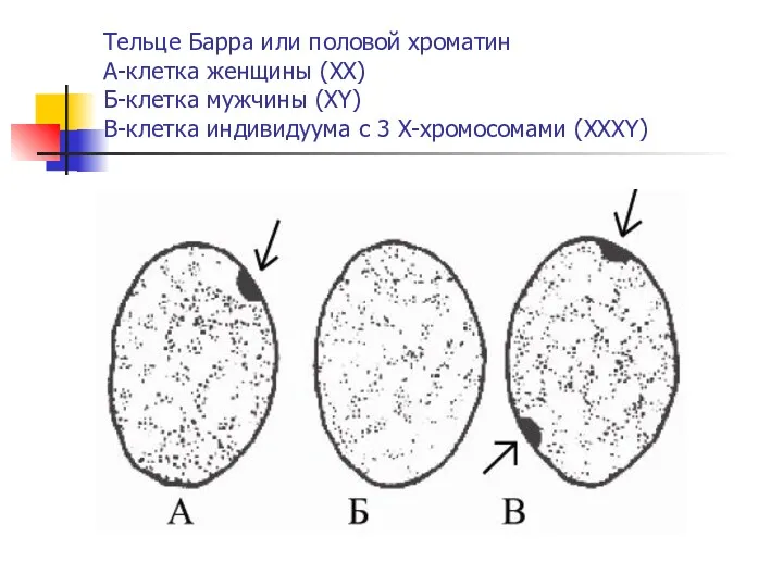 Тельце Барра или половой хроматин А-клетка женщины (ХХ) Б-клетка мужчины