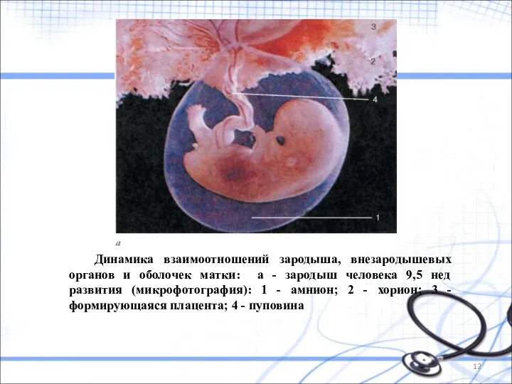 Динамика взаимоотношений зародыша, внезародышевых органов и оболочек матки: а - зародыш человека 9,5