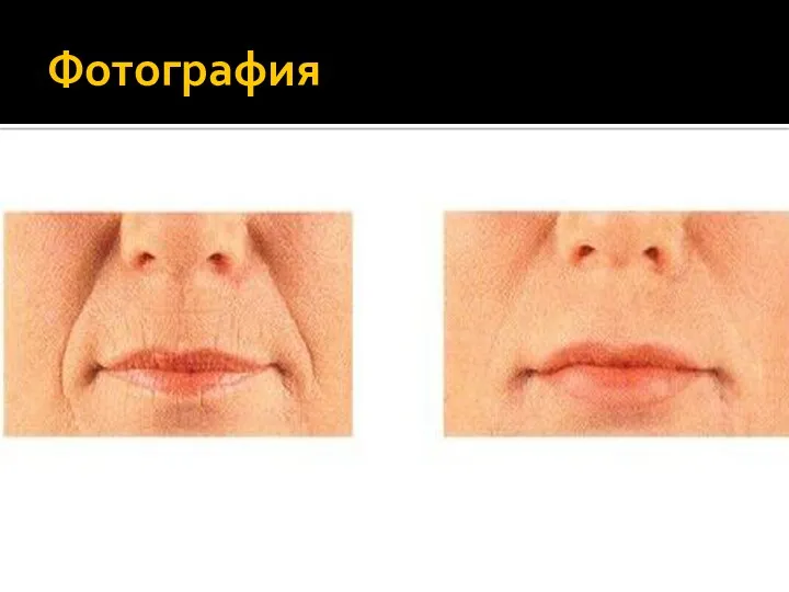 Фотография