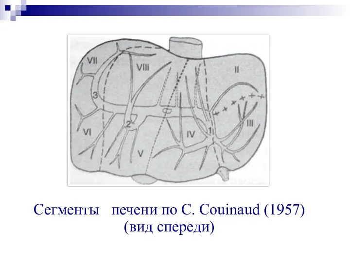 Сегменты печени по С. Couinaud (1957) (вид спереди)