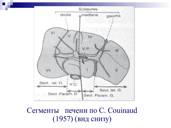 Сегменты печени по С. Couinaud (1957) (вид снизу)