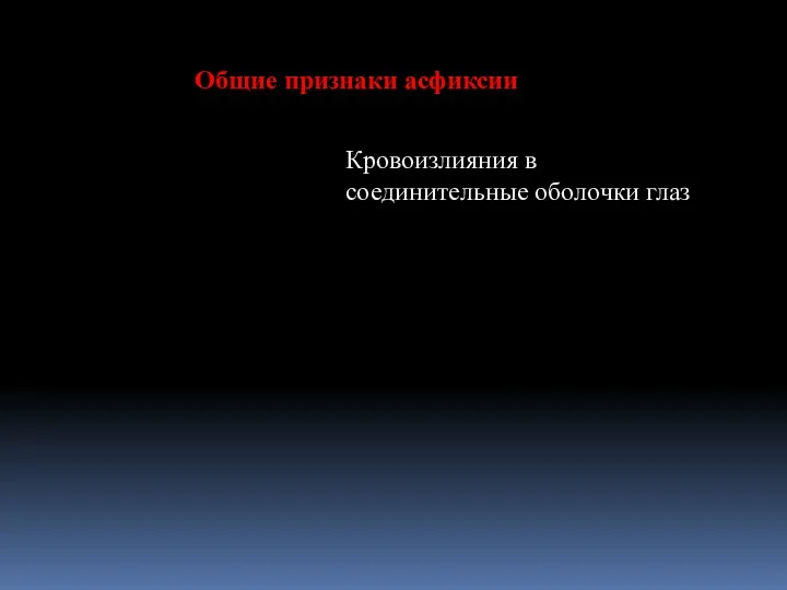 Общие признаки асфиксии Кровоизлияния в соединительные оболочки глаз