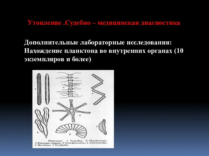 Утопление .Судебно – медицинская диагностика Дополнительные лабораторные исследования: Нахождение планктона