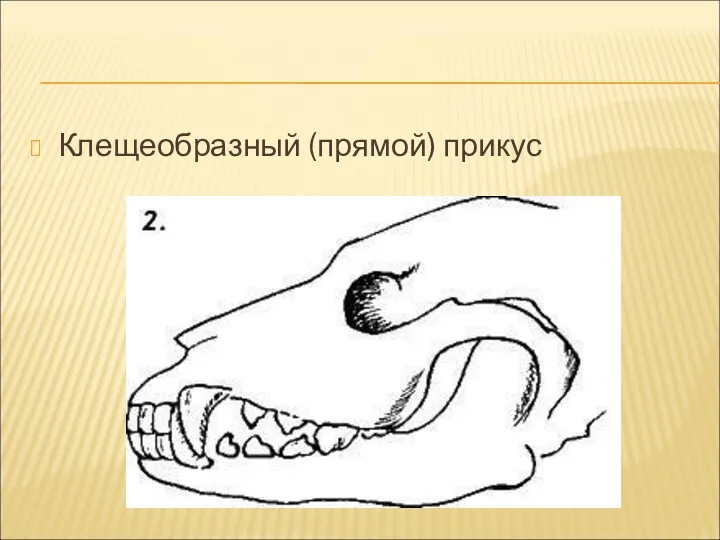 Клещеобразный (прямой) прикус