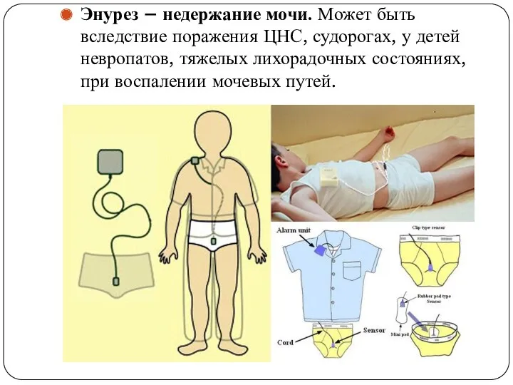 Энурез – недержание мочи. Может быть вследствие поражения ЦНС, судорогах,