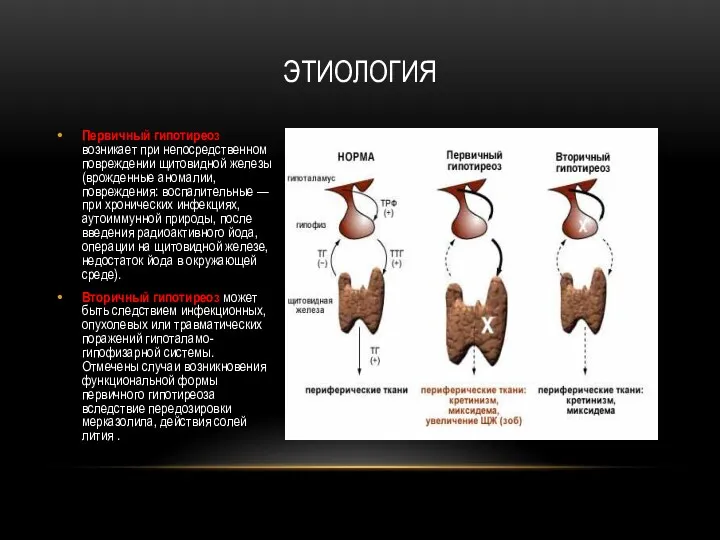 ЭТИОЛОГИЯ Первичный гипотиреоз возникает при непосредственном повреждении щитовидной железы (врожденные