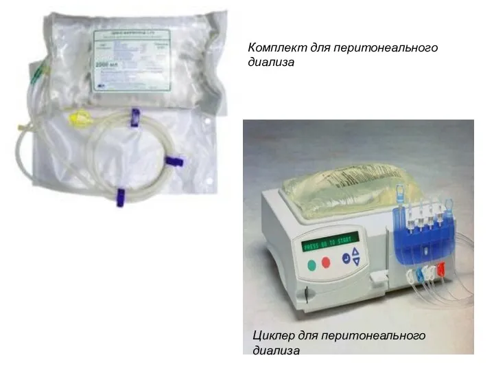 Комплект для перитонеального диализа Циклер для перитонеального диализа