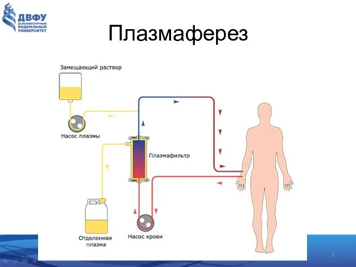 Плазмаферез