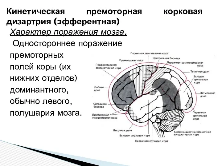 Характер поражения мозга. Одностороннее поражение премоторных полей коры (их нижних