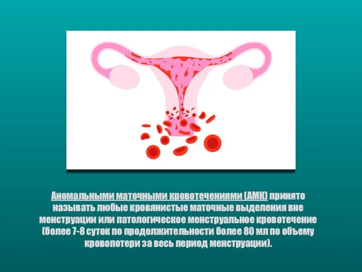 Аномальными маточными кровотечениями (АМК) принято называть любые кровянистые маточные выделения вне менструации или