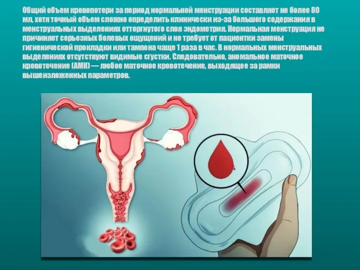 Общий объем кровопотери за период нормальной менструации составляет не более 80 мл, хотя