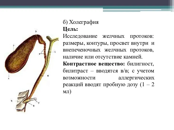 б) Холеграфия Цель: Исследование желчных протоков: размеры, контуры, просвет внутри