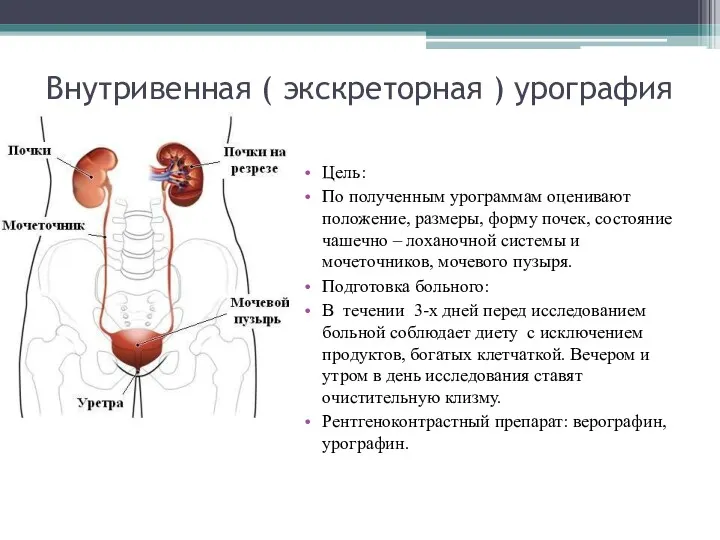 Внутривенная ( экскреторная ) урография Цель: По полученным урограммам оценивают