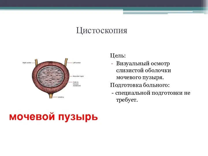 Цистоскопия Цель: Визуальный осмотр слизистой оболочки мочевого пузыря. Подготовка больного: - специальной подготовки не требует.