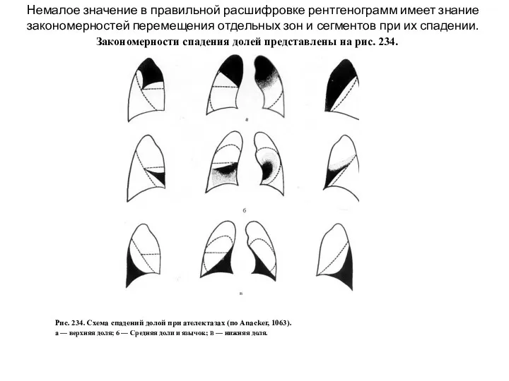 Немалое значение в правильной расшифровке рентгенограмм имеет знание закономерностей перемещения