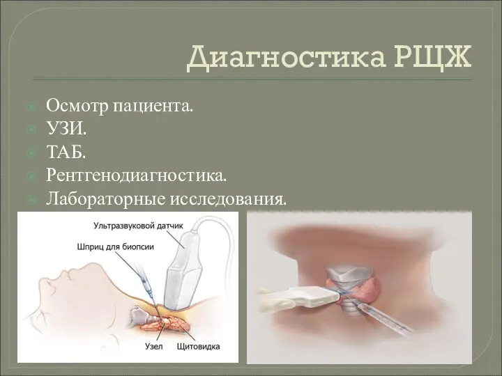 Диагностика РЩЖ Осмотр пациента. УЗИ. ТАБ. Рентгенодиагностика. Лабораторные исследования.