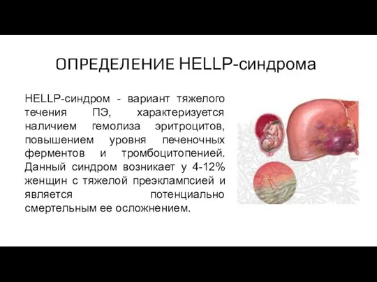 HELLP-синдром - вариант тяжелого течения ПЭ, характеризуется наличием гемолиза эритроцитов,