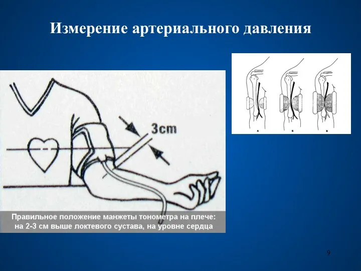 Измерение артериального давления