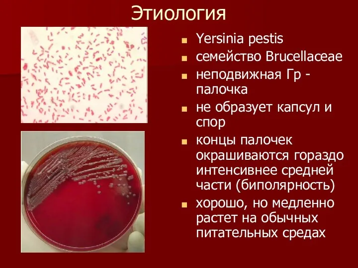 Этиология Yersinia pestis семейство Brucellaceae неподвижная Гр - палочка не