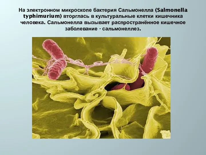 На электронном микроскопе бактерия Сальмонелла (Salmonella typhimurium) вторглась в культуральные клетки кишечника человека.