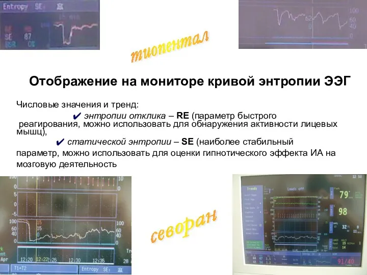 Отображение на мониторе кривой энтропии ЭЭГ Числовые значения и тренд: