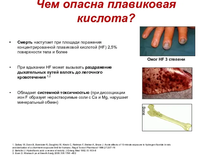 Чем опасна плавиковая кислота? Смерть наступает при площади поражения концентрированной