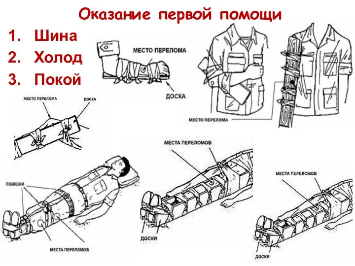 Оказание первой помощи Шина Холод Покой