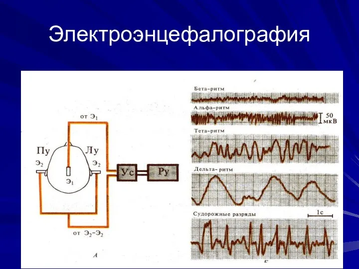 Электроэнцефалография