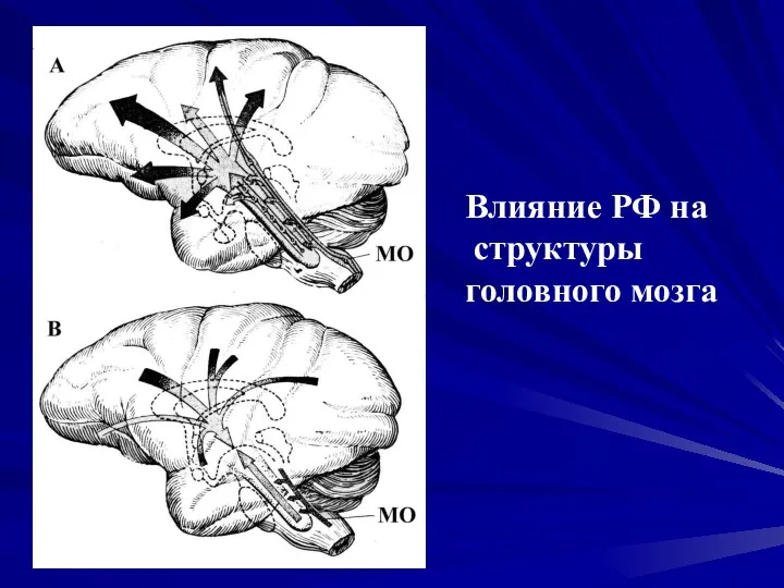 Влияние РФ на структуры головного мозга