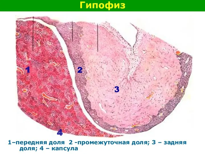 Гипофиз 1–передняя доля 2 -промежуточная доля; 3 – задняя доля;