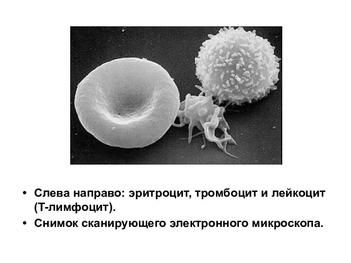 Слева направо: эритроцит, тромбоцит и лейкоцит (T-лимфоцит). Снимок сканирующего электронного микроскопа.