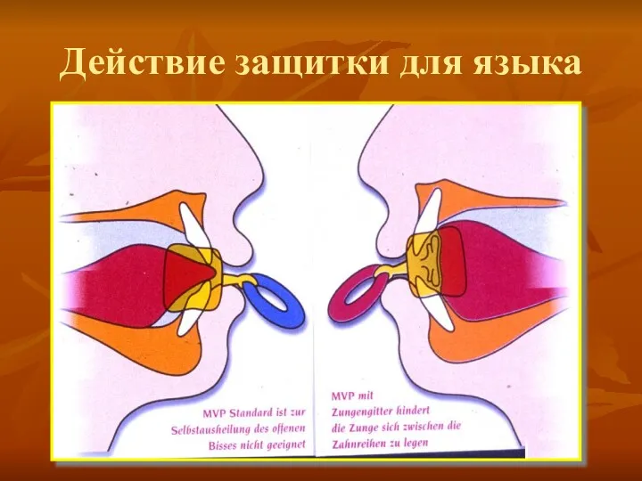 Действие защитки для языка