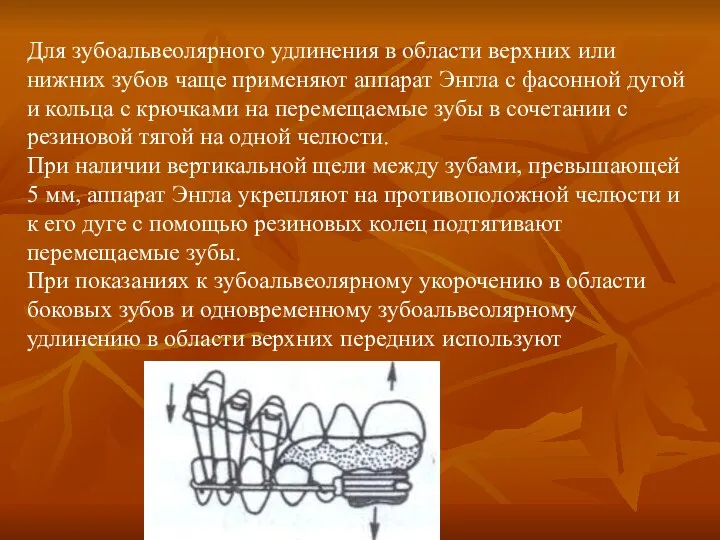 Для зубоальвеолярного удлинения в области верхних или нижних зубов чаще