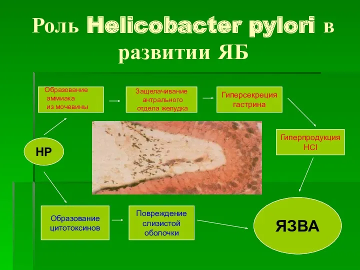Роль Helicobacter pylori в развитии ЯБ НР Образование аммиака из