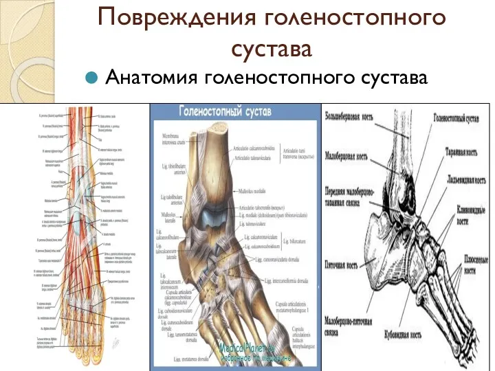 Повреждения голеностопного сустава Анатомия голеностопного сустава