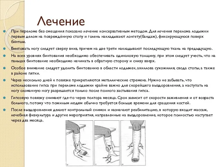 Лечение При переломе без смещения показано лечение консервативным методом. Для