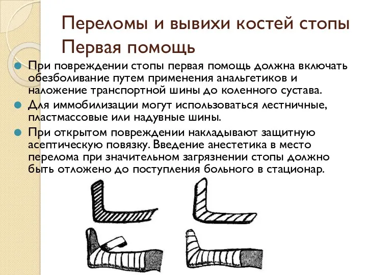 Переломы и вывихи костей стопы Первая помощь При повреждении стопы