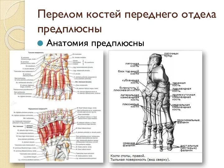 Перелом костей переднего отдела предплюсны Анатомия предплюсны