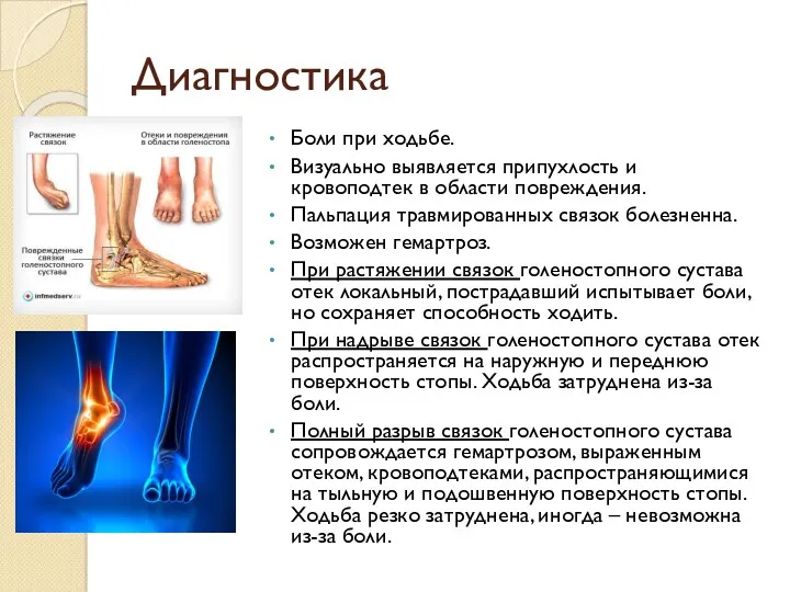 Диагностика Боли при ходьбе. Визуально выявляется припухлость и кровоподтек в