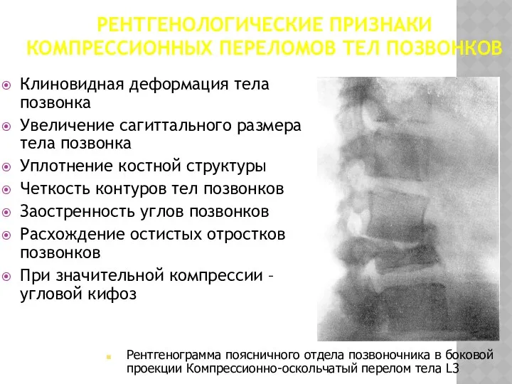 РЕНТГЕНОЛОГИЧЕСКИЕ ПРИЗНАКИ КОМПРЕССИОННЫХ ПЕРЕЛОМОВ ТЕЛ ПОЗВОНКОВ Клиновидная деформация тела позвонка