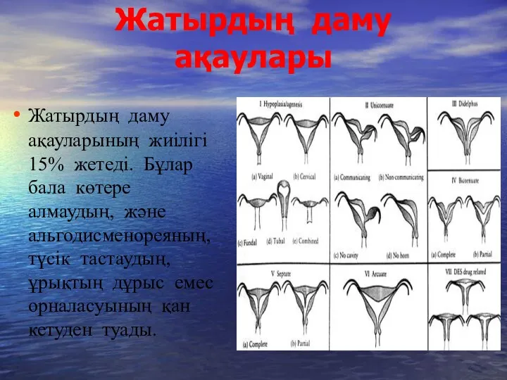 Жатырдың даму ақаулары Жатырдың даму ақауларының жиілігі 15% жетеді. Бұлар