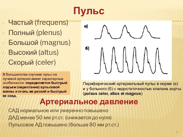 Пульс Частый (frequens) Полный (plenus) Большой (magnus) Высокий (altus) Скорый