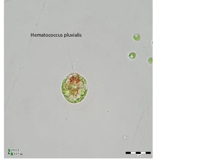 Hematococcus pluvialis