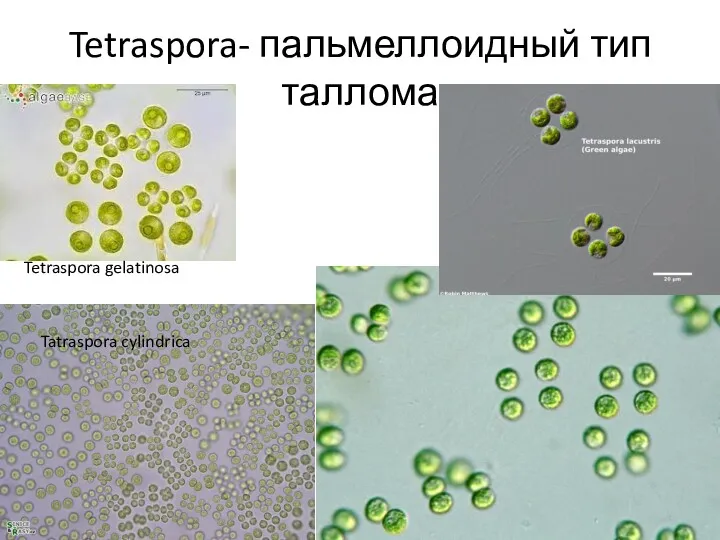 Tetraspora- пальмеллоидный тип таллома Tatraspora cylindrica Tetraspora gelatinosa