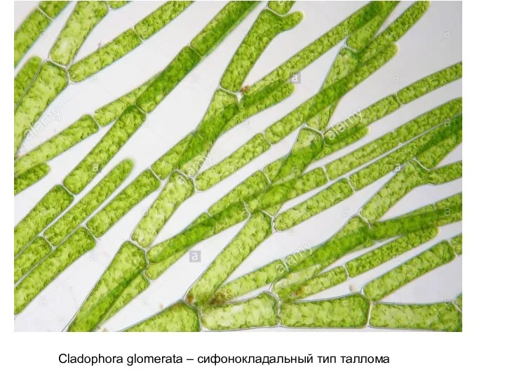 Cladophora glomerata – сифонокладальный тип таллома