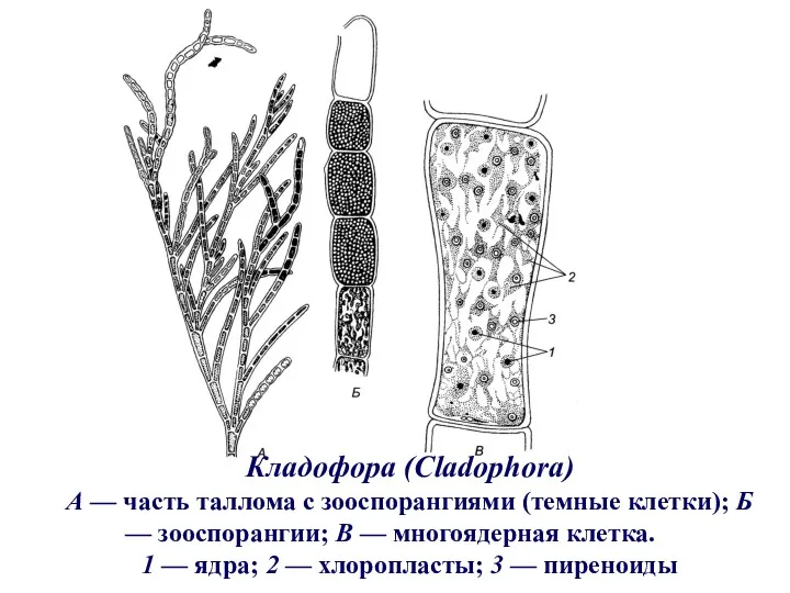 Кладофора (Cladophora) А — часть таллома с зооспорангиями (темные клетки);