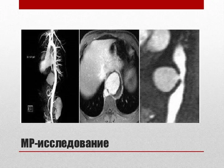 МР-исследование