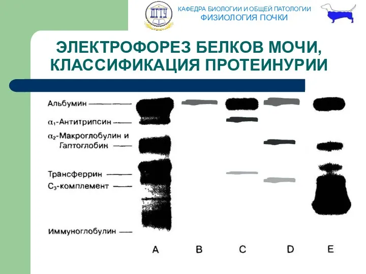 ЭЛЕКТРОФОРЕЗ БЕЛКОВ МОЧИ, КЛАССИФИКАЦИЯ ПРОТЕИНУРИИ