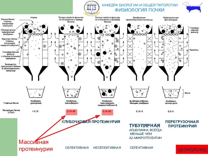 СЕЛЕКТИВНАЯ НЕСЕЛЕКТИВНАЯ ТУБУЛЯРНАЯ АЛЬБУМИНА ВСЕГДА МЕНЬШЕ ЧЕМ Α2-МИКРОГЛОБУЛИН ПЕРЕГРУЗОЧНАЯ ПРОТЕИНУРИЯ СЕЛЕКТИВНАЯ уромукоид КЛУБОЧКОВАЯ ПРОТЕИНУРИЯ Массивная протеинурия