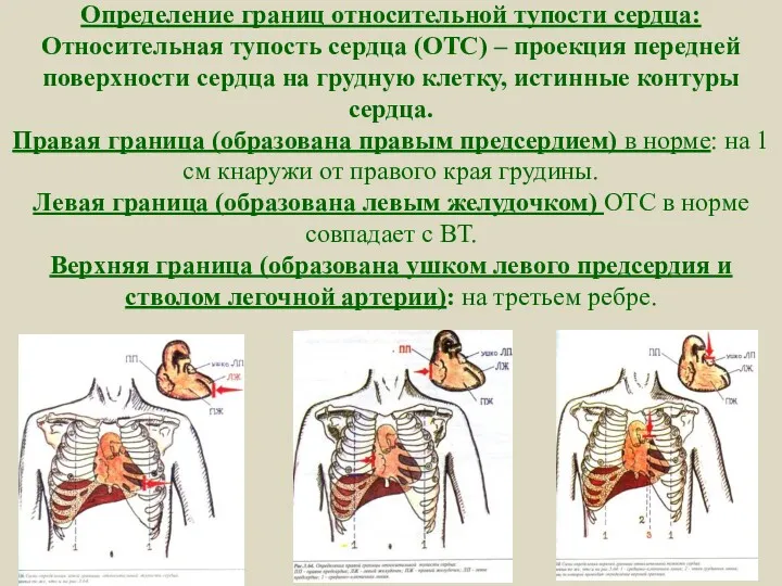 Определение границ относительной тупости сердца: Относительная тупость сердца (ОТС) – проекция передней поверхности